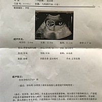 胎盘：前壁是啥意思有知道的吗？