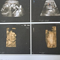 专业人士，帮忙看看是男宝女宝？