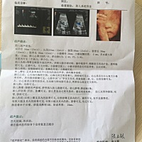 帮忙看下男孩女孩，胃过度充盈怎么回事。