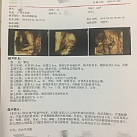 这是你的第一张照片！对我来说真的好宝贵！！！25