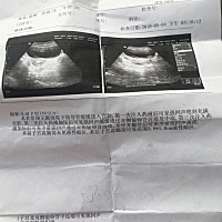 有人会看这个吗？这是做的输卵管造影。有人能看给我讲解一下。谢谢了。