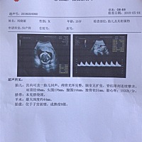 今天去做了B超，能看出男女吗？