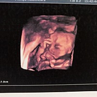 男孩儿还是女孩儿。    哈哈😄