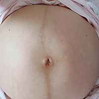 预产期18年5月15号的，有跟我同一天的吗？