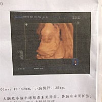 帮我看一下像男仔还是女仔？