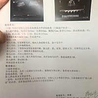 要做产前诊断了 真担心有没有什么问题！