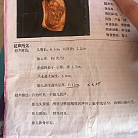 亲爱的宝妈们，帮忙看看男孩女孩。