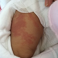 有没有知道这是怎么回事的，近两天才有的，按下去就不显了。