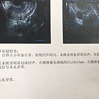 昨天下午四点做的b超，今天中午十二点测的排卵试纸，请问是排了吗？试纸会不会不准？昨天晚上已经同房过...