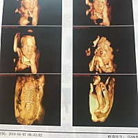 有没会看的宝妈，帮我看下男孩女孩，二胎好奇心太重😓😝