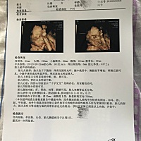 谁帮我看看四维彩超，有没有什么问题？