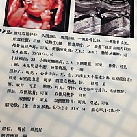 💋四维順利通过 求有经验的宝妈看看 男生女生 买衣服好买点😊