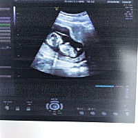 这个怎么去看男女?