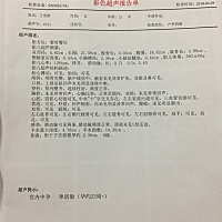 看看宝宝鼻子是不是蛮高的 可以猜猜男宝还是女宝