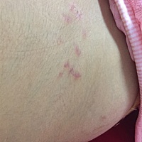 怀孕快七个月了 肚子两边有这种东西 有懂得吗 这是什么