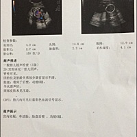 有谁能看懂吗？
