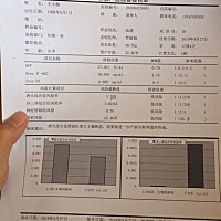 什唐氏综合征风险截断值1:189高风险，医生又让做了DNA，不知道结果会怎么样