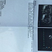 那位大神会看男女，帮忙看看，纯属好奇哦！已经16周了