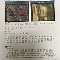 想问一下大家，这是男孩还是女孩啊