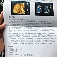 求看男女求看男女