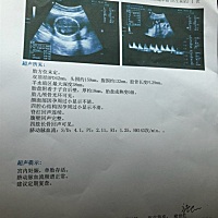 请问有人会看是男孩还是女孩吗？