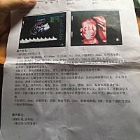 看不懂，求有经验的帮忙看看，谢谢