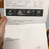 大家帮忙看看男宝还是女宝