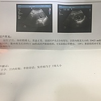 想让各位宝妈们看看是否能看出男孩女孩。🙏了