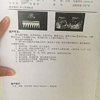 21周做彩超，麻烦亲们看看是男宝还是女宝