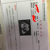 谁能看出来是男宝还是女宝 ps：比较喜欢女宝