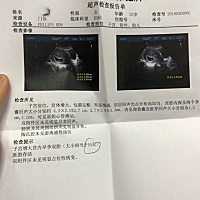 看看男宝还是女宝