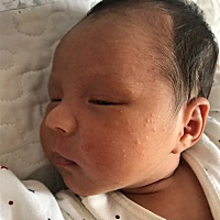 宝宝21天 脸上这两天长湿疹 不敢随便擦药 也不敢吃药 各位宝妈有没有遇到我这样的 有没有什么法子 😭...