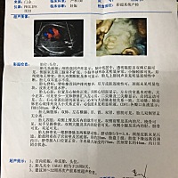 感觉宝宝鼻子嘴巴好丑，是不是跟别人照的四维不太一样…哪里可以看出男女？