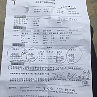 唐筛结果谁能看的懂？医生说话含含糊糊的心里可忐忑