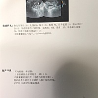 有没有孕妈和我这情况一样的，羊膜囊囊壁上可见一个强回声啊。有知道的宝妈麻烦白忙中抽出一点时间给我...