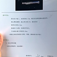 大家帮我看看男宝女宝？很好奇，谢谢啦