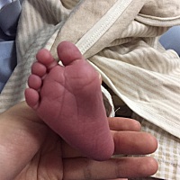 2018.5.10    成功剖宫产小帅哥一枚   那种痛真的是一辈子都不想再经历一次了   （看到小家伙就觉得一切...