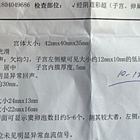 亲们帮我看下这个是不是有子宫肌瘤