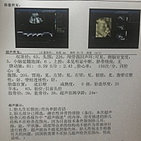 大家看这个单子 能看得出男女么  帮我看一下 嘻嘻 纯属娱乐哈