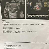 各位亲们帮我看下男还是女谢谢