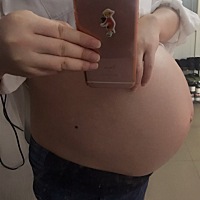 5月11日剖腹产得6斤1两男宝宝，孕期超爱喝水和吃水果，没有妊娠纹和黑线，给好奇男宝女宝的妈妈参考参考