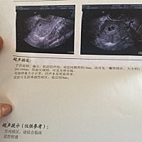 希望大家帮我看一下！末次月经3月26日，今天已经48天了，没来月经，平常经期是40天左右的，也有一两个月...