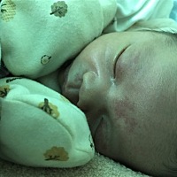 宝宝出生12天了，出生的时候额头眼睛皮上就有这样的红点一直没消下去，平的不凸出，好着急😭有谁知道...