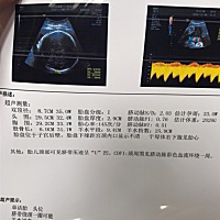 帮忙看下是男孩还是女孩 谢谢了