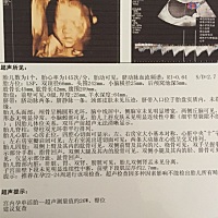 四维顺利 照的时候说头大