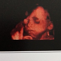 四维顺利通过，好奇看看是男是女，也祝大家的四维都能顺利通过😁