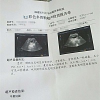 最后一次月经3月11号，怀孕两个多月，前期一直有褐色分泌物，时多时少，刚刚两个月的时候有一天晚上出很...