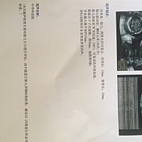 能看出男孩女孩吗？有谁经验比较丰富的，比较好奇