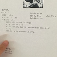 孩子是不是头大腿短😒😒