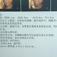 刚做的四维，双侧腕及踝关节显示欠理想，要不要紧